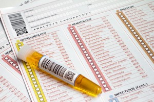 urine test for lung cancer