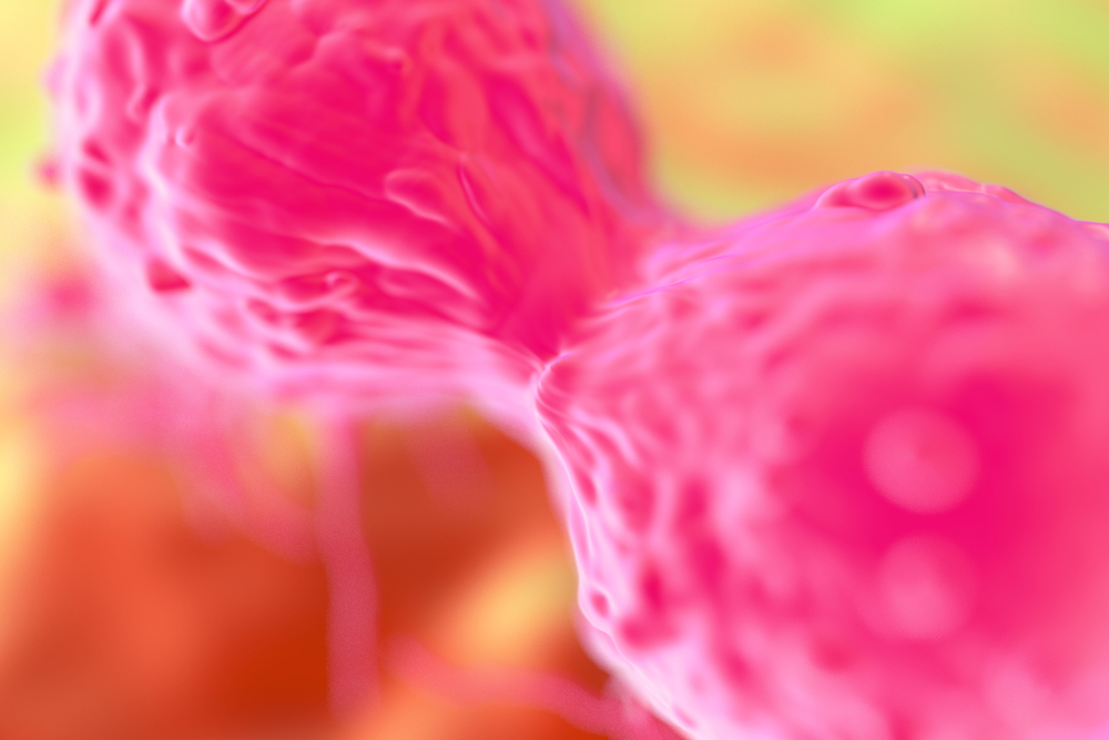 Novel Antibody Increases Squamous NSCLC Patients’ Survival